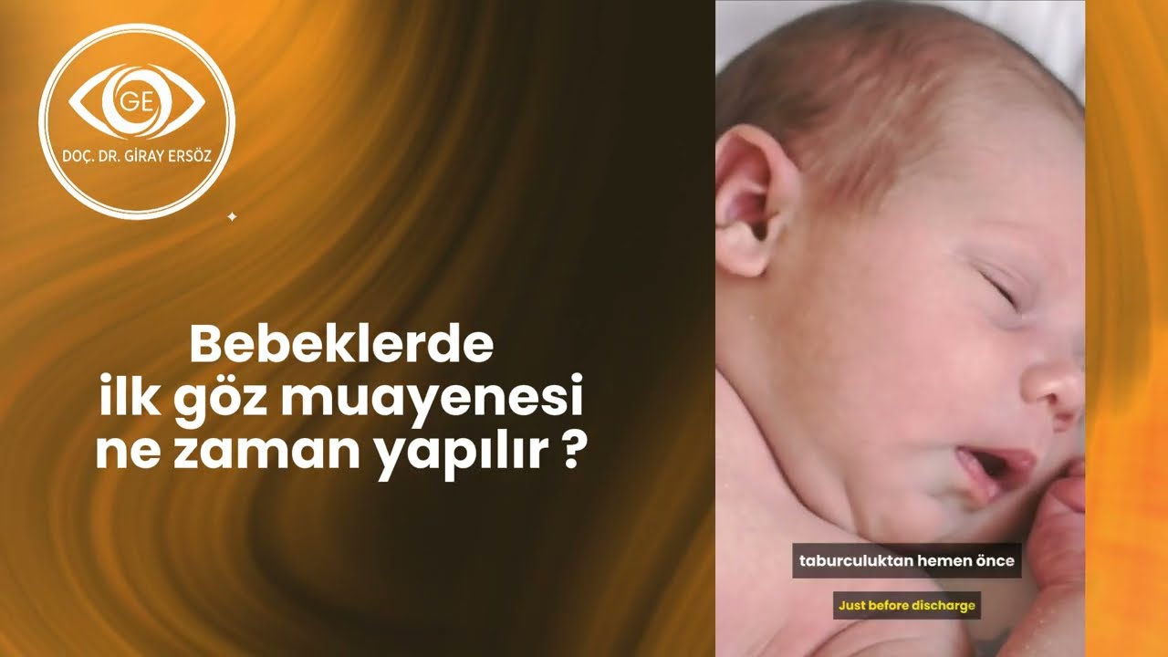 Bebeklerde İlk Göz Muayenesi Ne Zaman ve Nasıl yapılır?