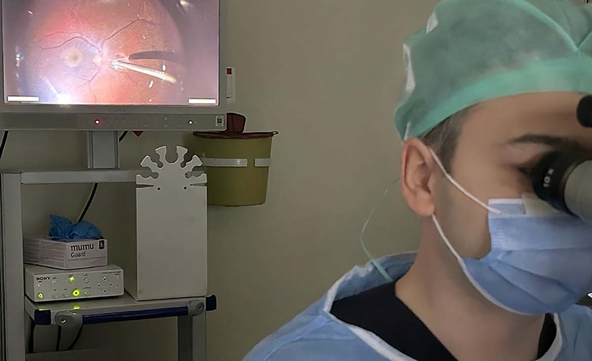 What is Retinal Detachment? How is Retinal Detachment treated?