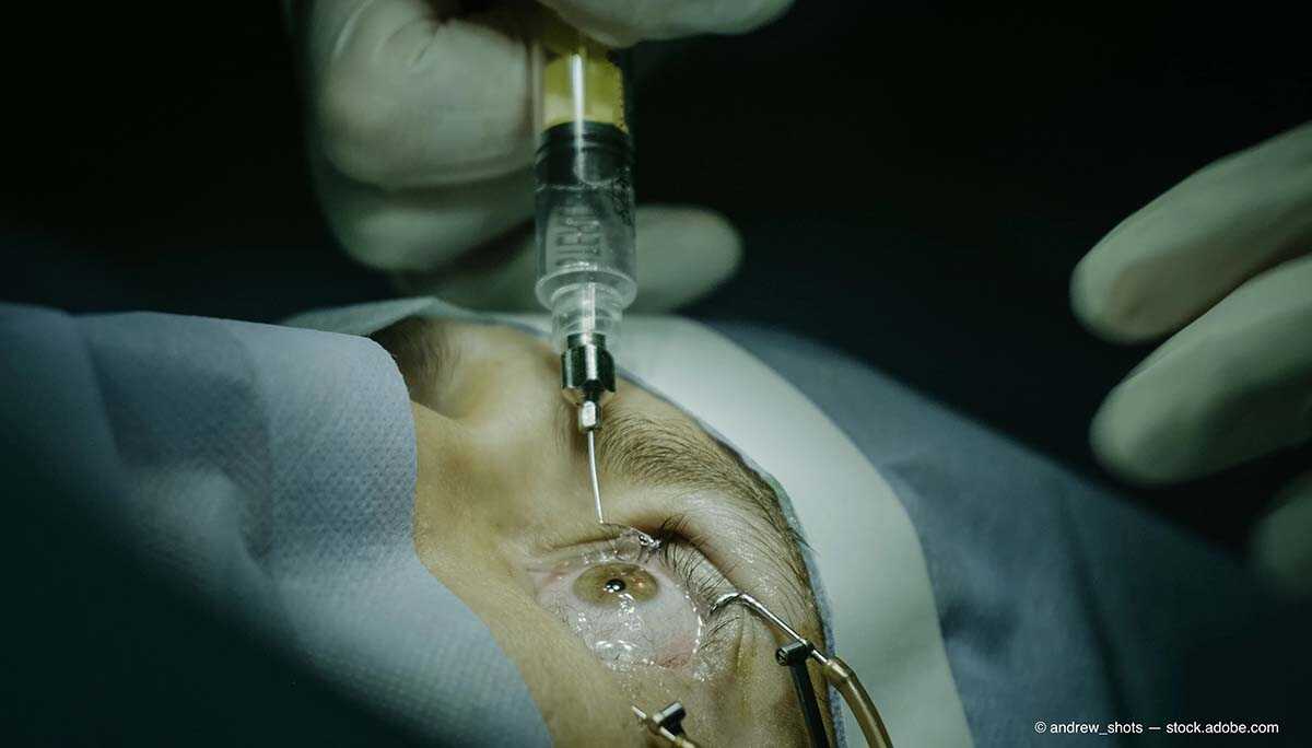göz içi iğne tedavisi nedir? hangi göz hastalıklarına uygulanmaktadır?