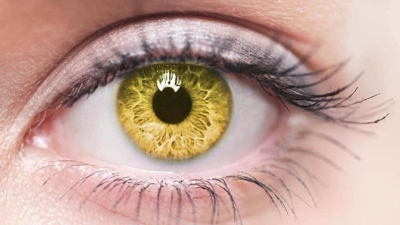 Macular Degeneration: Understanding its Origins, Symptoms, and Treatment