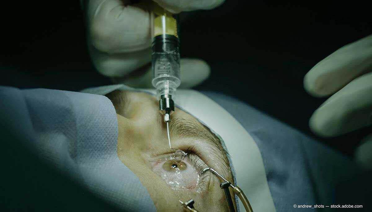 What is Intraocular Needle Treatment? How it is Performed?