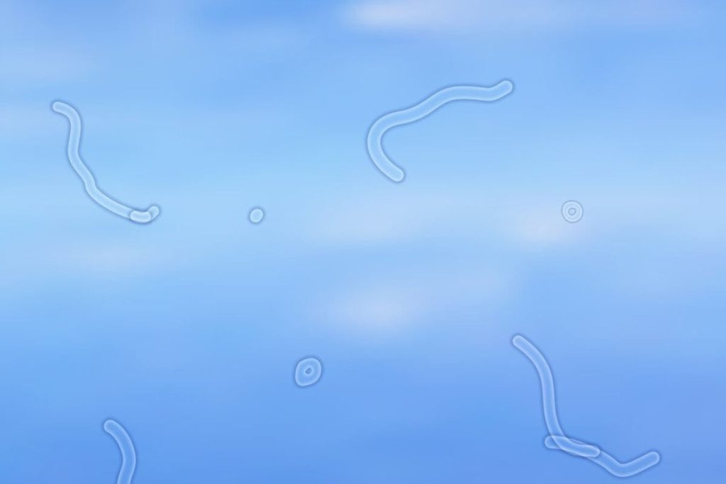 Causes and Treatment of Eye Floaters