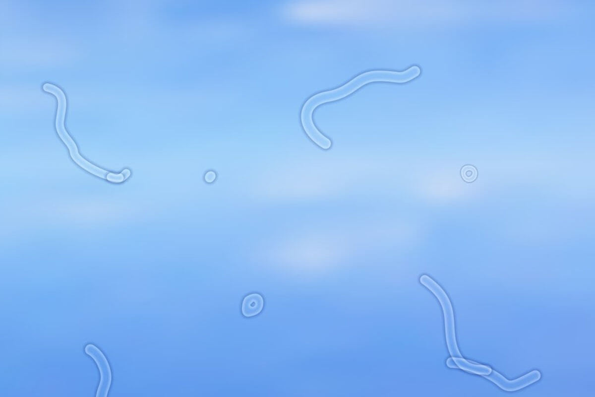 Understanding and Managing Eye Floaters Causes, Frequency, and Treatment Options