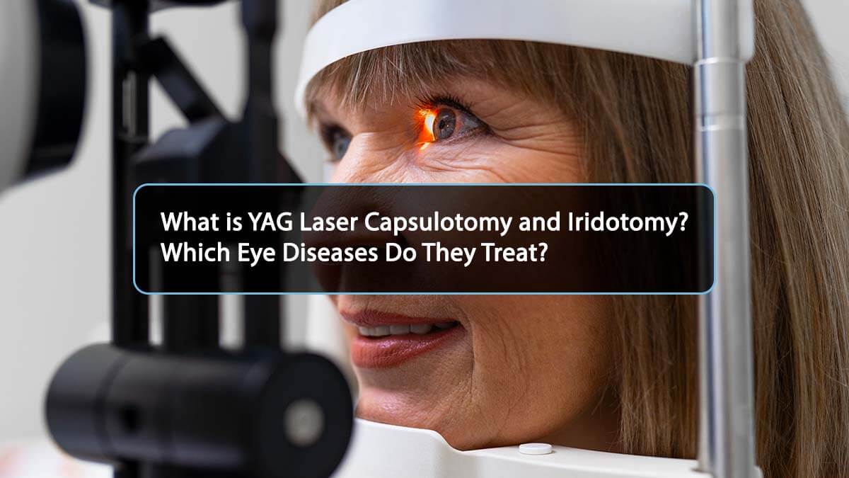 Lentille Chirurgicale YAG Pour Capsulotomie & Iridectomie - Verre +70D | Professionnel (CE/ISO)